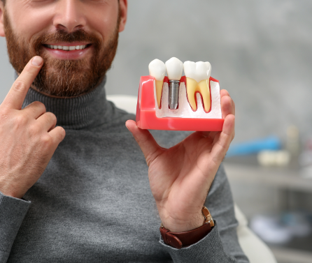 Man holding teeth model