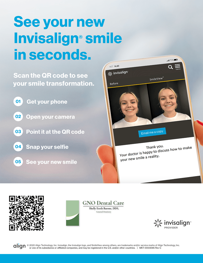 Invisalign before and after